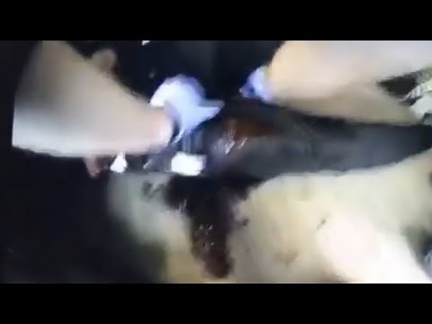 Cop Applies a Tourniquet After Action Medical Report