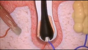 Ungex Visual Catalog Learn more about Ungex Demodex Treatment | Hair Mites Ungex