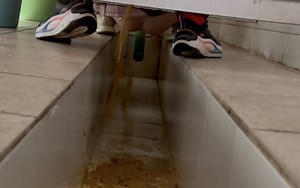 Elder woman have diarrhea everywhere