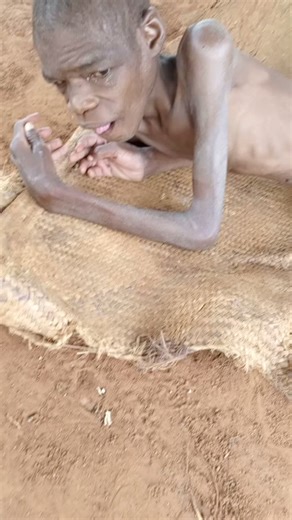 So sad 😭😭 Be a blessing into Nathan's life with your support. He needs medication and basic needs | God's Love Ministries