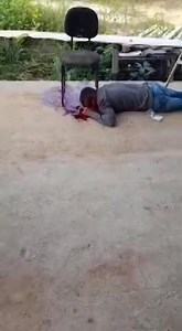 Dude Has A Chair Leg Stuck In His Head