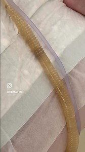 Gut cleansing with a colonic irrigation #loveyourgut #coloncleanse #colondetox #colonhealth