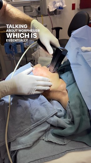 FaceTite Morpheus8 = a combination unlike any other! 🌟 FaceTite is a minimally invasive facial and neck contouring procedure that provides visible and natural results. 🌟 Morpheus8 delivers exceptional skin, tissue, and collagen remodeling to improve skins appearance and reduce irregularities. #augplastic #inmode #facetite #morpheus8 #augustaga #kardashians #evansga | Augusta Plastic Surgery