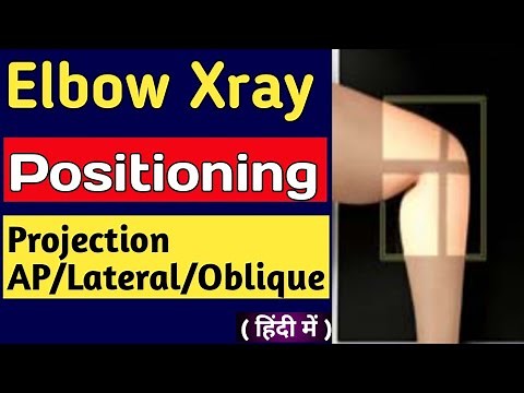 Elbow X-Ray positioning | Elbow Ap/Lateral view | Oblique view | External & Internal oblique view.
