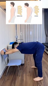 Fix your hunchback posture with this exercise #vungocson #drson | Vũ Ngọc Sơn