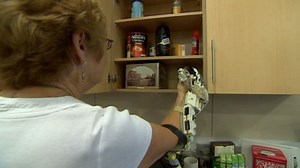 Robotic exoskeleton aids hand movement after stroke