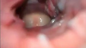 Anal inside camera