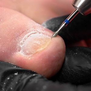 203K views · 2.4K reactions | Check out this extreme pedicure transformation! | Beauty Studio | Facebook