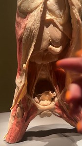 The bodies are preserved using a process called plastination, where water and fat are replaced with plastic, allowing for long-term display and detailed examination. Part 3 | Princess Vi