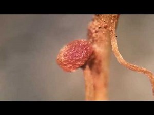 Nitrogen fixing bacteria (rhizobia) found in legume root nodule