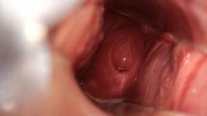 I like to show my cervix
