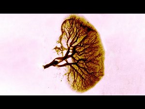 A Woman Nibbled On A Burger Sitting On Her Desk For Days. This Is What Happened To Her Kidneys.