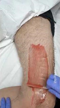 Male upper leg wax service using Coral hard wax formula from Starpil