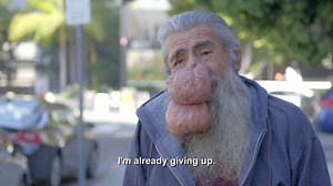 Roger's Story (As seen on TLC & Dr. Pimple Popper) - Osborne Head & Neck Foundation