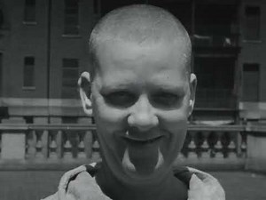 Hysteria (Bellevue Hospital Neurological and Neuro-surgical Service, Sarah P. Shiras, 1945)