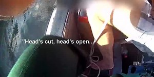 GRAPHIC: Snorkeler hit by boat propeller while diving for lobsters