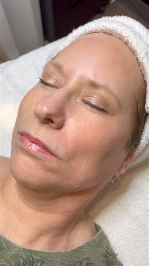 2.2K views · 17 reactions | Going into the Holiday weekend like… Happy to announce that our West Chester location now offers three days of skin care.  Days include: Monday, Wednesday, and Thursdays! #dermaplaning #skin | The Plastic Surgery Group | Facebook