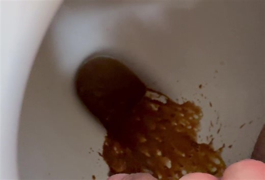 Liquid Diarrhea - video 4