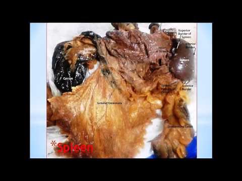 Surgical Anatomy of Cadaveric Abdominal Viscera - Dr Sanjoy Sanyal