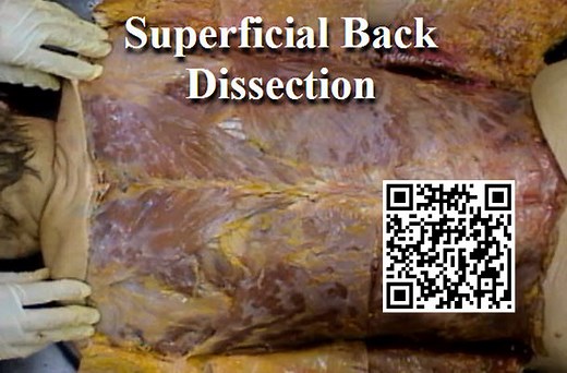 Dissection: Superficial Back - Anatomy Guy