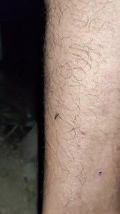 6.1K views · 13 reactions | Female mosquitoes need a blood meal to produce eggs #mosquito #mosquitos #mosquitoes #mosquitobites #mosquitorepellent #mosquitokiller #mosquitocontrol #mosquitolagoon #mosquitonet #mosquitohead #mosquitobite #mosquitopl #mosquitoseason #mosquitocoast #mosquitospray #mosquitonets | Lexus Pet Boutique | Facebook