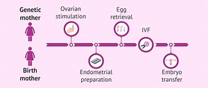 What is reciprocal IVF? - IVF with donor egg from female partner