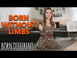 Born Without Limbs And I Can Still Do Anything | BORN DIFFERENT