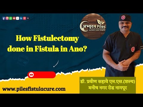 How Fistulectomy done in Fistula in Ano?