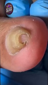 20K views · 176 reactions | Daily Habits for Safe and Gentle Toenail Cleaning 凉 #DailyCare #NailCare #HealthySteps | NC State Wolfpack on TheWolfpacker.com | Facebook