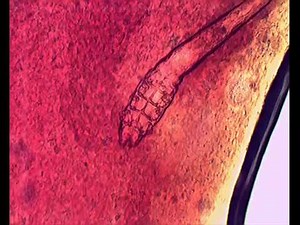 A Live Female Demodex Under Microscope