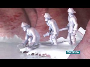 CA154 Gaviscon Fireman 30s