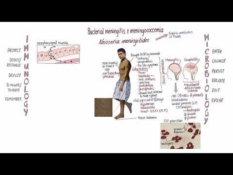 Meningococcemia Springboard