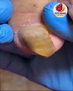 14K views · 133 reactions | Smart Health Tips for Senior Nail Care For Active Daily Routines#SeniorHealth #SafeSteps #EverydayCare #FootSupport | Tots Mags Wheel | Facebook