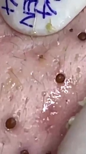 it's disgusting | ASMR Animation Videos