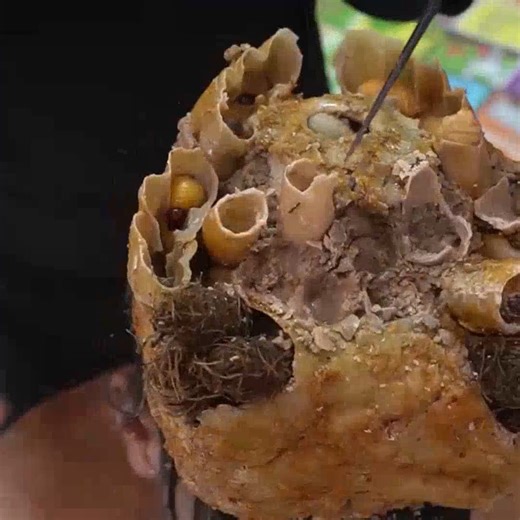 Satisfying Psoriasis!! Help Scratching Huge Dandruff And Removal Giant Worms Nest #804 #ticks #removetick #Dandruff #dandrufftreatment #dandruffremoval | Help remove ticks