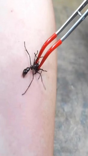 Bullet ant stings with danny_berk in Costa Rica and exposing coyote Peterson! Full video on my YouTube channel SKUM TALES . #stung #bulletant #ant #costarica #coyote #party #pitviper #viral #babes #keepitskummy #skumtales - - #skumtales #keepitskummy #pitviper #party #buttsnorkeler #adventure #travel #fullsend #stunts #babes #florida #sendit #snowboarding #snorkel #hawaii #japan #skateboarding #jackass #skateboard #moto #thrasher #swampfest #friends #❤️SKATEBOARDERS #utah #thailand #weekend #sum