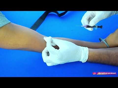 How To Do Venous Blood Sampling (Venipuncture) : Step-by-Step Description of Procedure : Clinicals