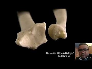 ARTICULACION RADIO CUBITAL DISTAL