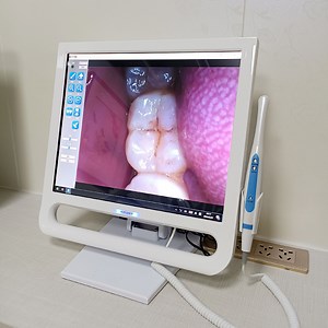 [Hot Item] Dental Intraoral Camera with All-in-One Touch Screen Computer for Dental Units