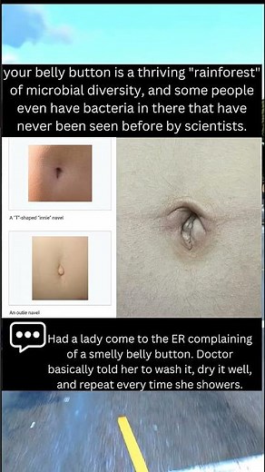 ⬇️⬇️ Navel Explained: Belly Button Facts, Shapes, & Hygiene Guide #shorts