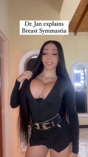 Have you ever heard the term Symmastia? Dr. Jan explains this condition in today’s video. Leave a comment if you have any questions! Doc will be happy to answer them 🙌 #plasticsurgeryjamaica #plasticsurgeon plasticsurgeon in jamaica, kingston jamaica