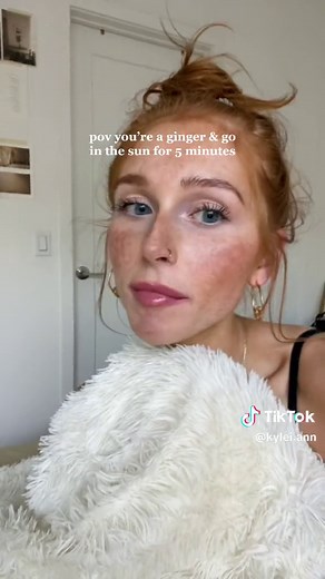 Ginger with Freckles POV - Five Minutes in the Sun