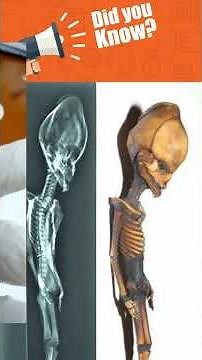 The Mystery of the Atacama "Alien" Mummy