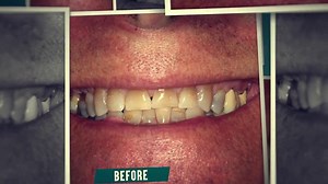 North River Dental on Reels