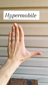 #stitch with @Ashley anyone else with alien hands?👽😂#hypermobile #hypermobilitycheck #adhshe #autisminwomen #fyp | Tracy Rodriguez, CES