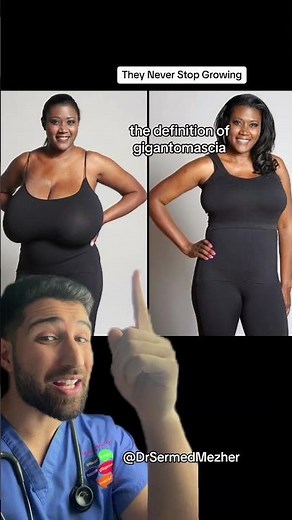 They Never Stop Growing #gigantomastia