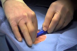 What is the Loop Recorder? Discovering Home Telemetry