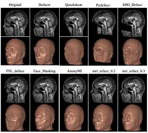 Reproducibility evaluation of the effects of MRI defacing on brain segmentation