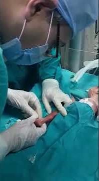 PICC line insertion 2 dr Mohamed