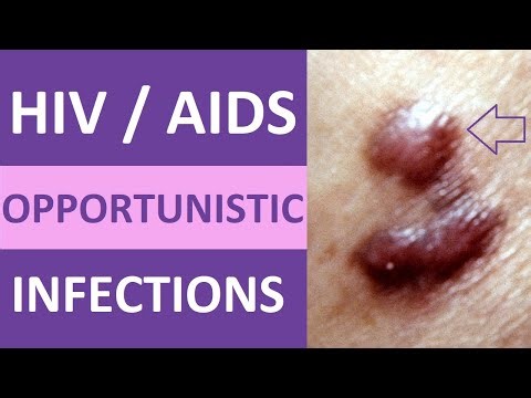 HIV Opportunistic Infections Made Easy for Nursing School & NCLEX